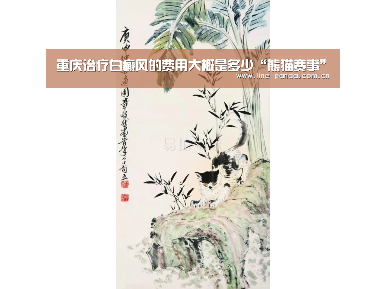 重庆治疗白癜风的费用大概是多少“熊猫赛事”(图2) 熊猫体育官网